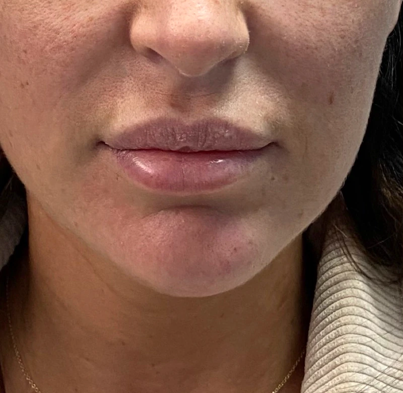 Before: Fullness that stays in balance