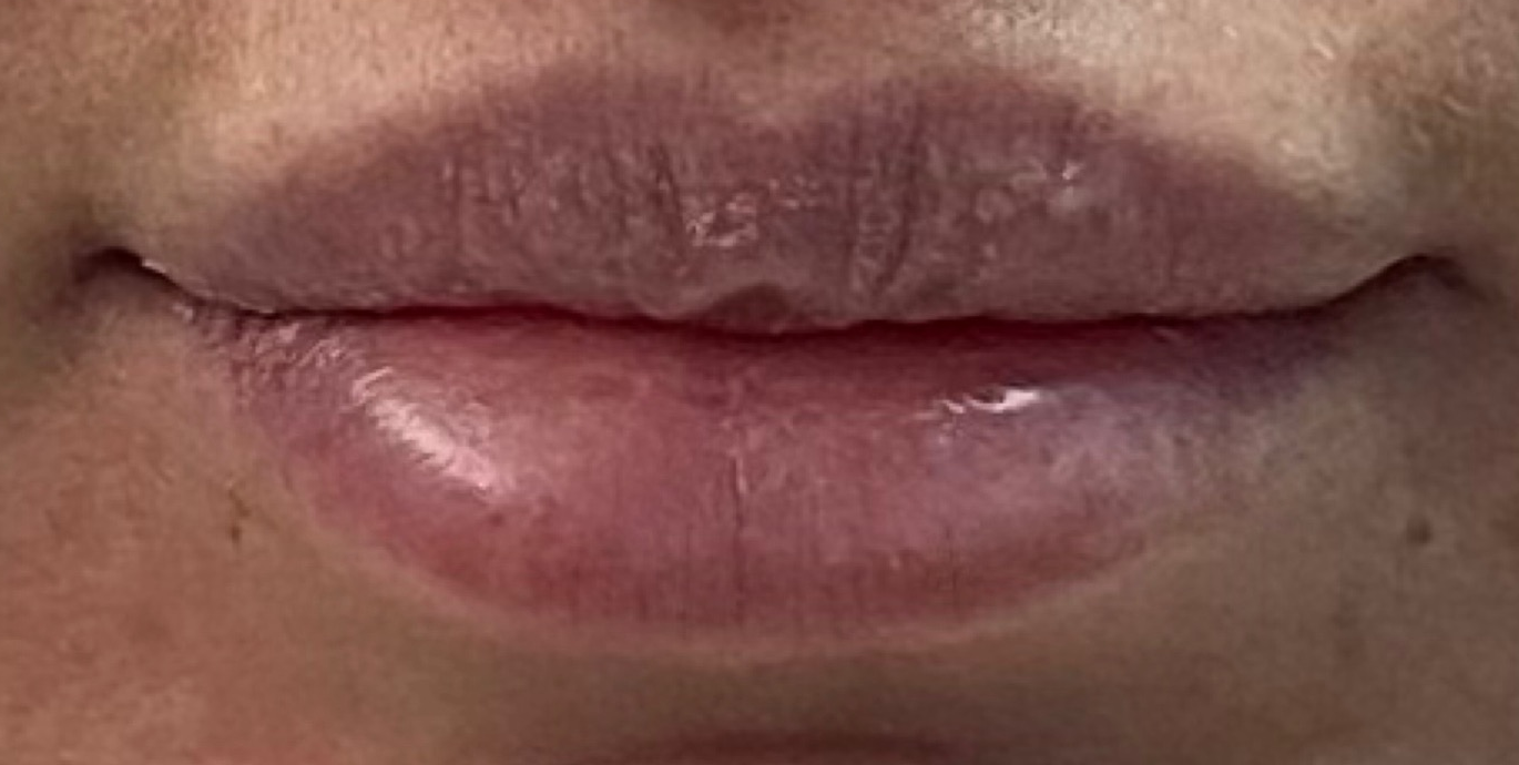 Before: A fuller look